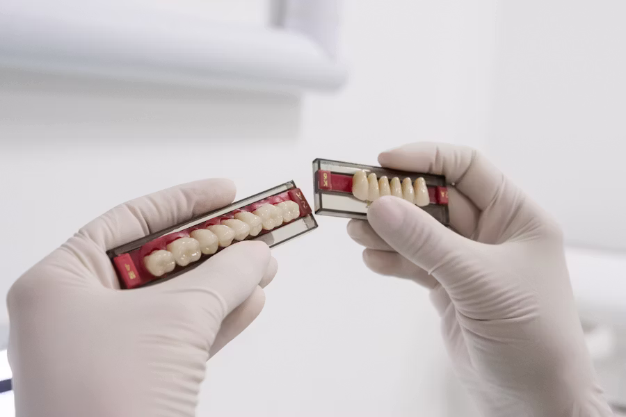 Cura dell'impianto dentale — Clinica Monti
