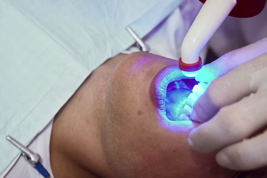 Sbiancamento denti professionale in studio — Clinica Monti