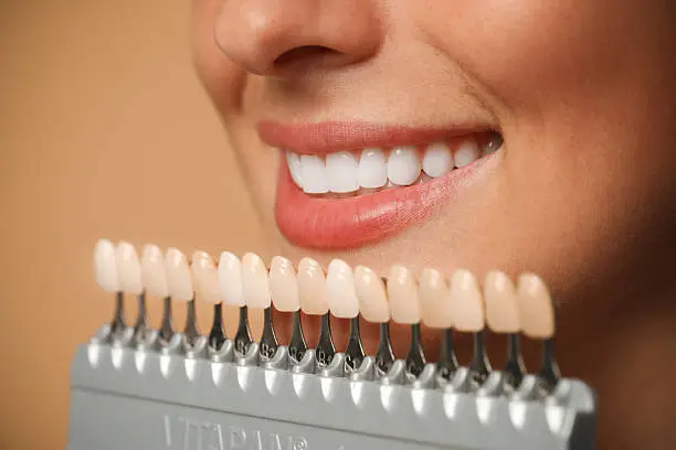 Sorriso perfetto con trattamenti di estetica dentale — Clinica Monti